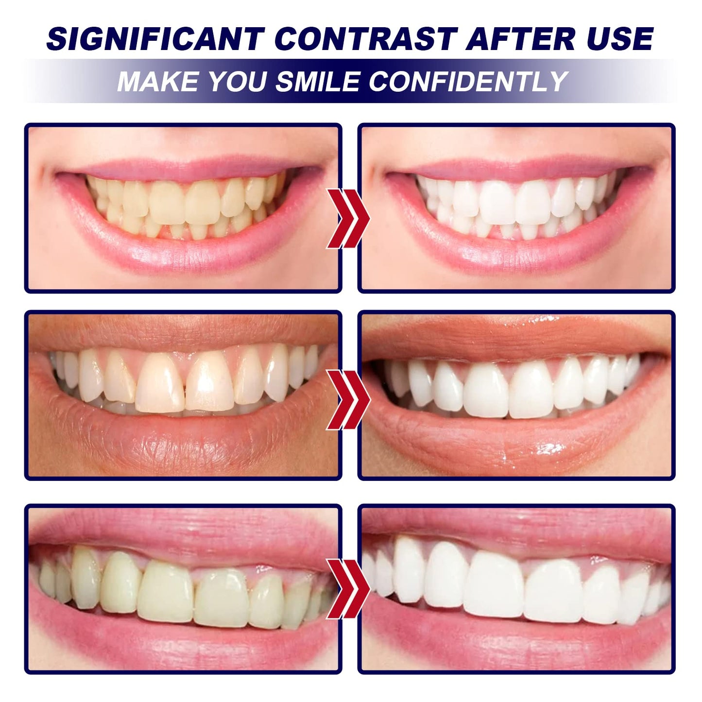 Whitening Strips