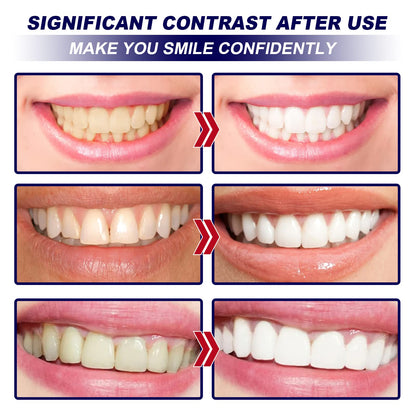 Whitening Strips